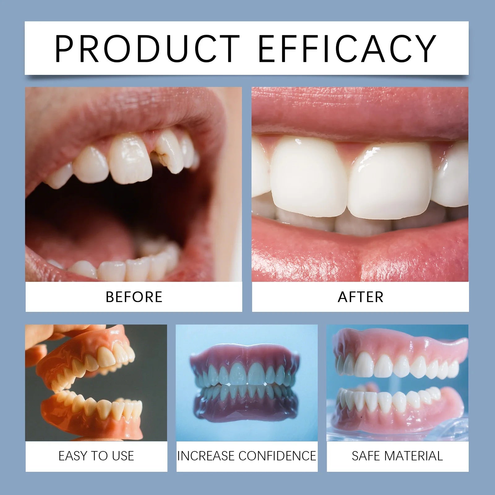 Gel-Fit Resin Denture Set — Cover Tooth Loss & Perfect Your Smile